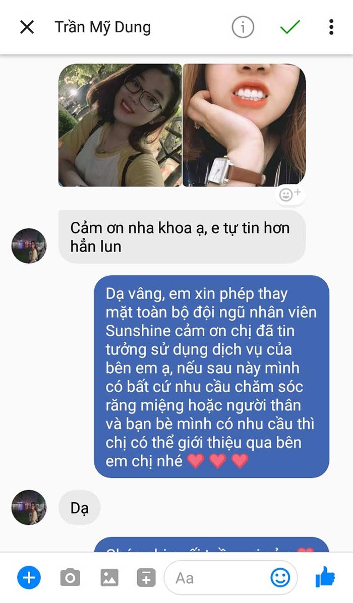 review bọc răng sứ