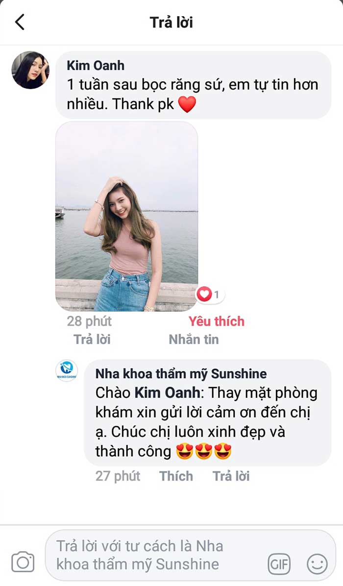 review bọc răng sứ