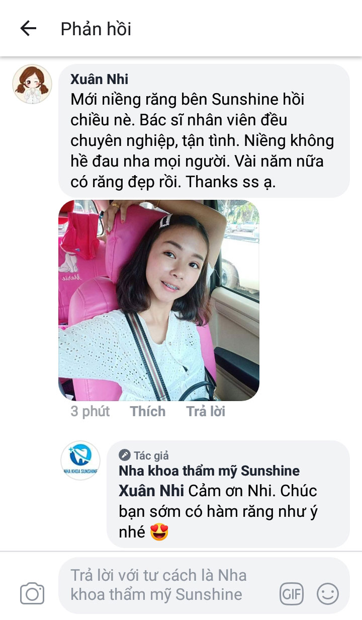 review niềng răng