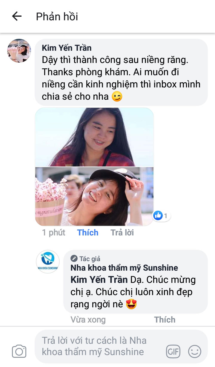 review niềng răng