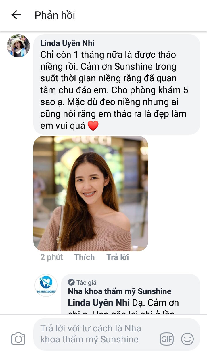 review niềng răng