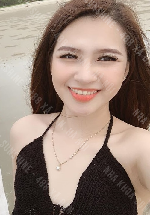 răng sứ ht smile giá bao nhiêu