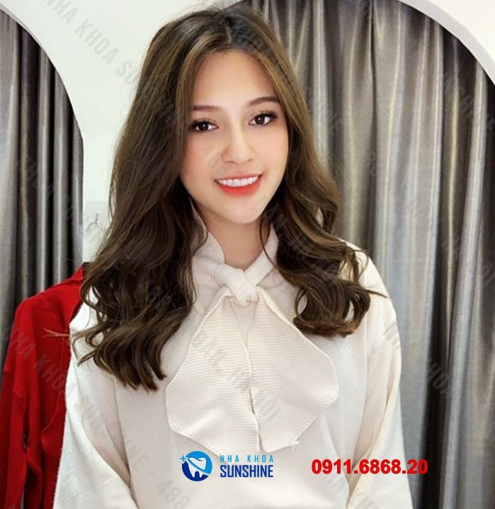 răng sứ ht smile giá bao nhiêu