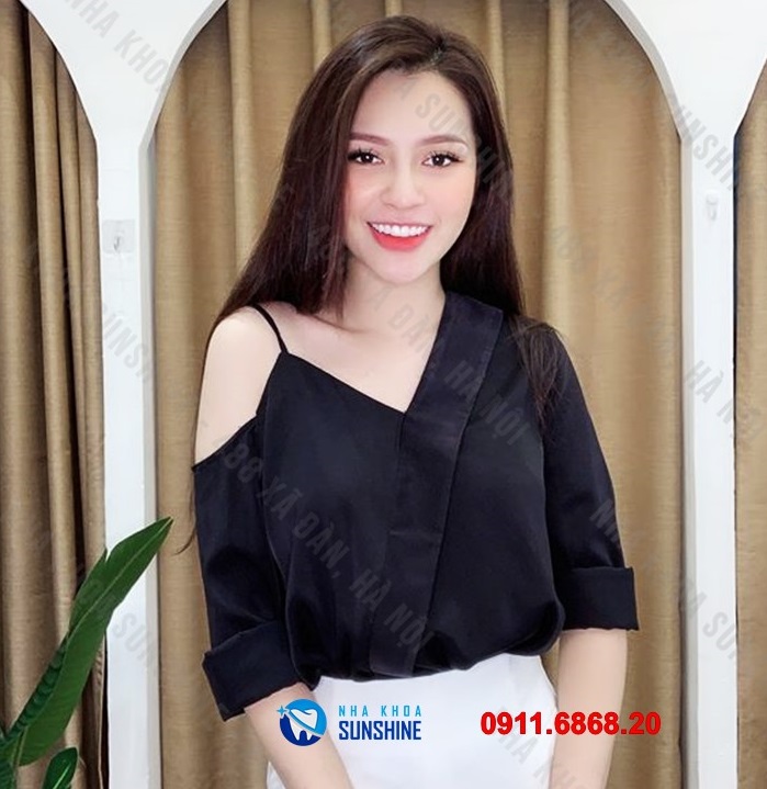 răng sứ ht smile giá bao nhiêu