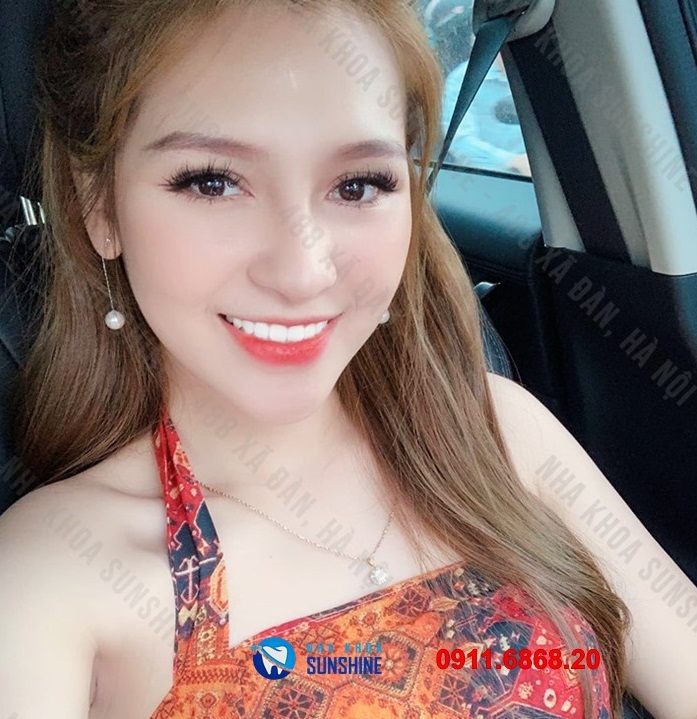 răng sứ ht smile giá bao nhiêu