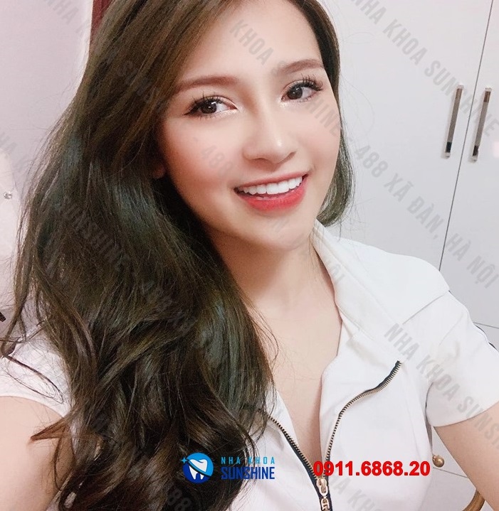 răng sứ ht smile giá bao nhiêu