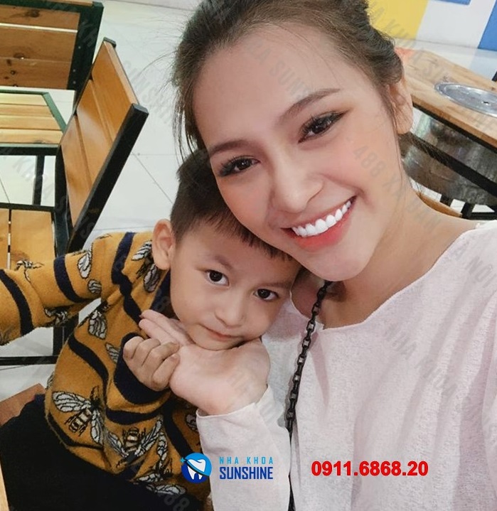 răng sứ ht smile giá bao nhiêu