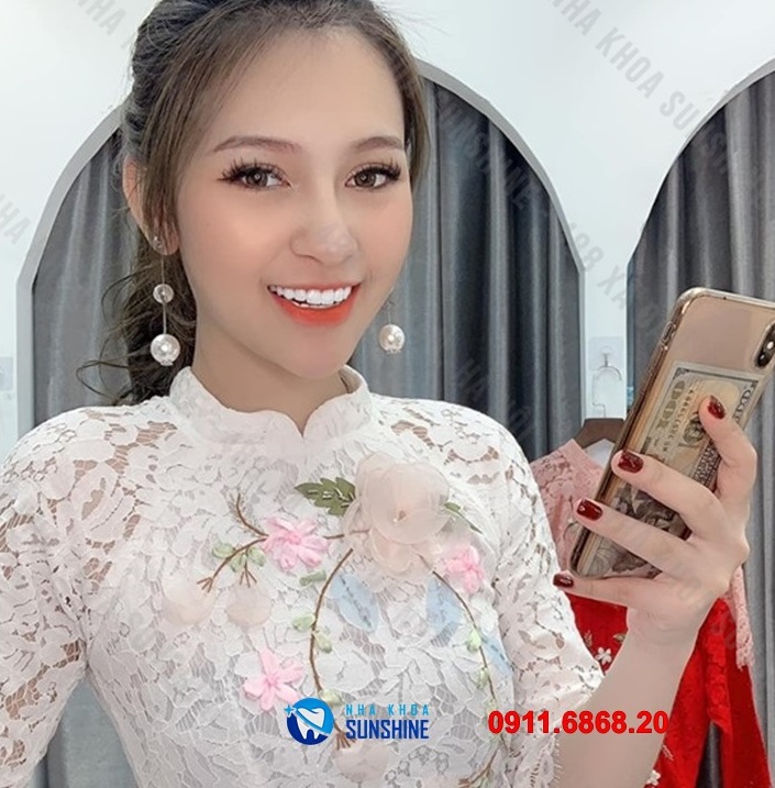 răng sứ ht smile giá bao nhiêu