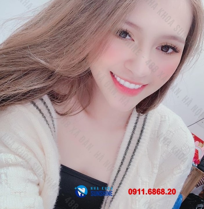 răng sứ ht smile giá bao nhiêu