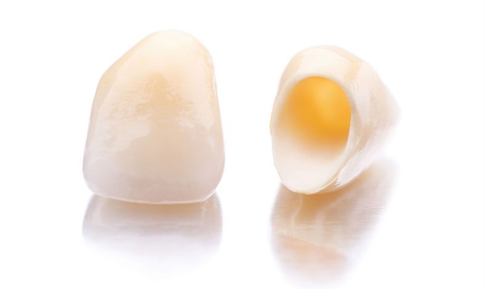 răng sứ zirconia có mấy loại