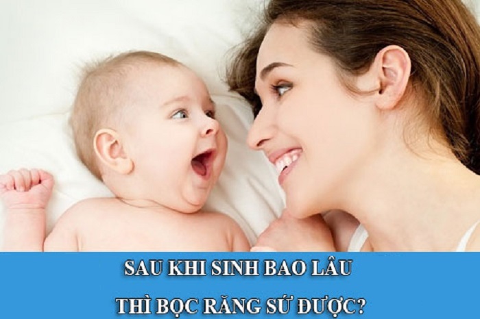 sau sinh bao lâu thì bọc răng sứ được