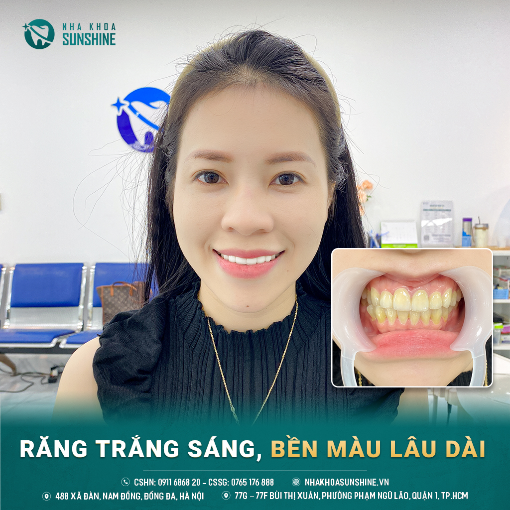 tay-trang-rang-cong-nghe-whitemax4.0-hieu-qua