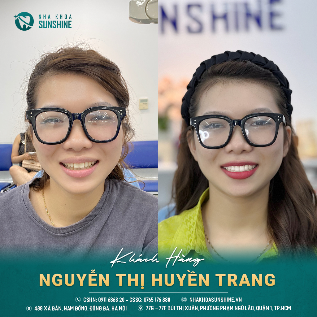 tay-trang-rang-cong-nghe-whitemax4.0-hieu-qua