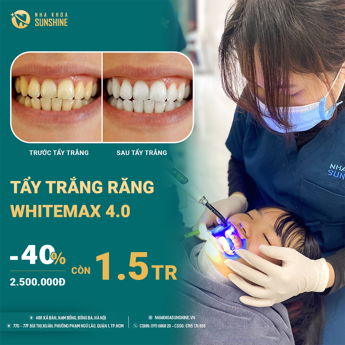 tay-trang-rang-cong-nghe-whitemax4.0-hieu-qua