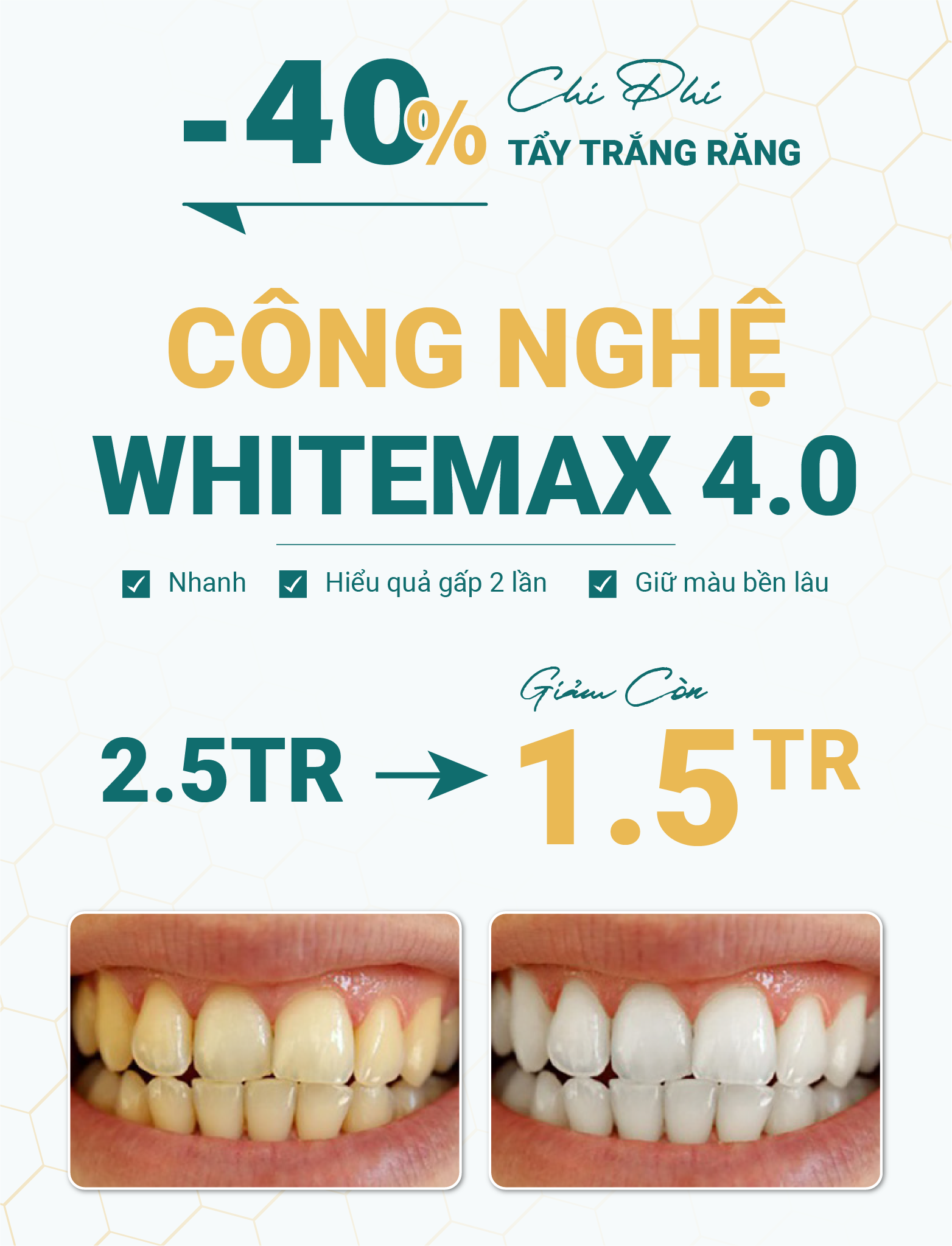 tay-trang-rang-cong-nghe-whitemax-4-0-nhanh-hieu-qua-ben-mau