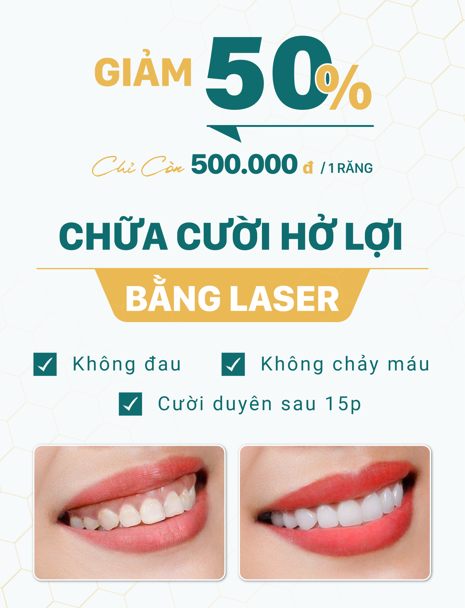 chua-cuoi-ho-loi-bang-laser-khong-chay-mau-chi-sau-15-phut