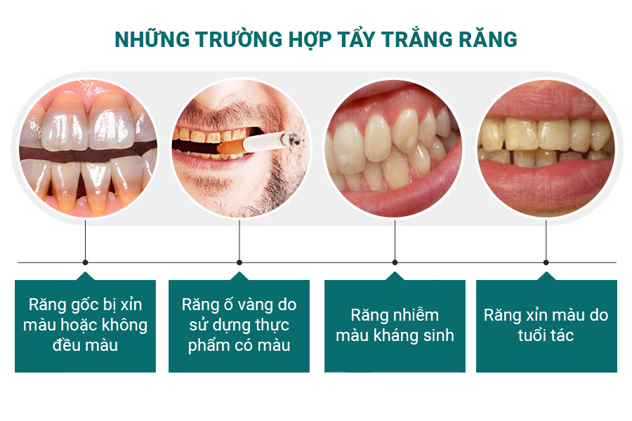 tay-trang-rang-cong-nghe-whitemax4.0-hieu-qua