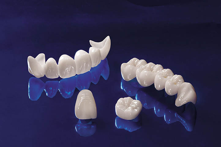 răng sứ ceramill có tốt không